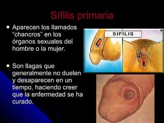 Sífilis primaria Aparecen los llamados “chancros” en los órganos sexuales del hombre o la mujer. Son llagas que generalmente no duelen y desaparecen en un tiempo, haciendo creer que la enfermedad se ha curado. 