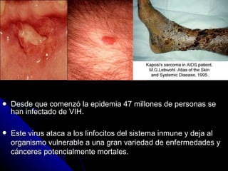 Desde que comenzó la epidemia 47 millones de personas se han infectado de VIH. Este virus ataca a  los linfocitos del sistema inmune  y deja al organismo vulnerable a una gran variedad de enfermedades y cánceres potencialmente mortales. 