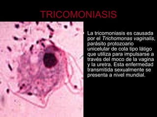 TRICOMONIASIS La tricomoniasis es causada por el  Trichomonas vaginalis , parásito protozoario unicelular de cola tipo látigo que utiliza para impulsarse a través del moco de la vagina y la uretra. Esta enfermedad transmitida sexualmente se presenta a nivel mundial. 