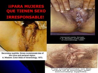 ¡¡PARA MUJERES QUE TIENEN SEXO IRRESPONSABLE!   