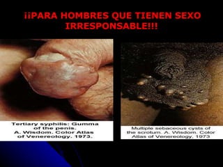 ¡¡PARA HOMBRES QUE TIENEN SEXO IRRESPONSABLE!!!   