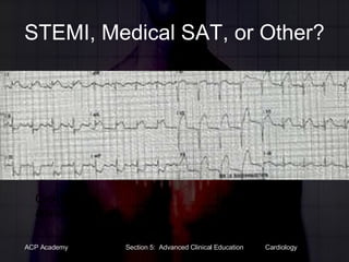 STEMI, Medical SAT, or Other? Click for answer 