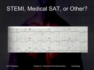 STEMI, Medical SAT, or Other? Click for answer 