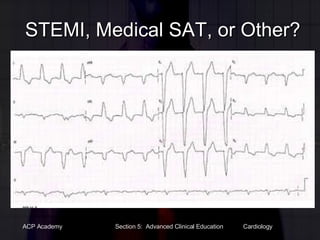 STEMI, Medical SAT, or Other? 