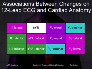 Associations Between Changes on 12-Lead ECG and Cardiac Anatomy aVF  inferior III  inferior V 3   anterior V 6  lateral aVL  lateral II  inferior V 2   septal V 5   lateral aVR I  lateral V 1  septal V 4  anterior 