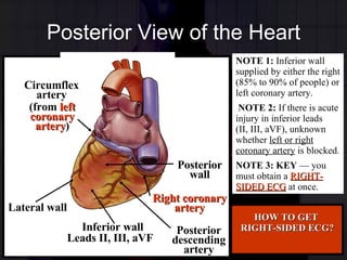 Posterior View of the Heart NOTE 1:  Inferior wall supplied by either the right (85% to 90% of people) or left coronary artery. NOTE 2:  If there is acute injury in inferior leads  (II, III, aVF), unknown whether  left or right coronary artery  is blocked. NOTE 3: KEY   —  you must obtain a  RIGHT-SIDED ECG  at once. HOW TO GET  RIGHT-SIDED ECG? Leads II, III, aVF (from  left coronary artery ) Lateral wall Inferior wall Right coronary artery Posterior descending artery Posterior wall Circumflex artery 