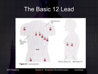 The Basic 12 Lead 