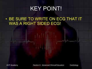 KEY POINT! BE SURE TO WRITE ON ECG THAT IT WAS A RIGHT SIDED ECG! 