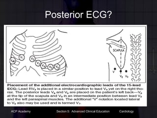 Posterior ECG? 