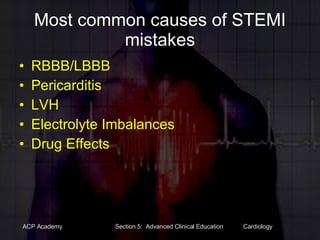 Most common causes of STEMI mistakes RBBB/LBBB Pericarditis LVH Electrolyte Imbalances Drug Effects 