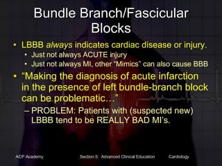 Bundle Branch/Fascicular Blocks LBBB  always  indicates cardiac disease or injury. Just not always ACUTE injury Just not always MI, other “Mimics” can also cause BBB “ Making the diagnosis of acute infarction in the presence of left bundle-branch block can be problematic…” PROBLEM: Patients with (suspected new) LBBB tend to be REALLY BAD MI’s.  