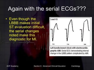 Again with the serial ECGs??? Even though the LBBB makes initial ST evaluation difficult, the serial changes noted make this diagnostic for MI. 