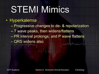 STEMI Mimics Hyperkalemia Progressive changes to de- & repolarization T wave peaks, then widens/flattens PR interval prolongs, and P wave flattens QRS widens also 