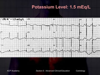 Potassium Level: 1.5 mEq/L 