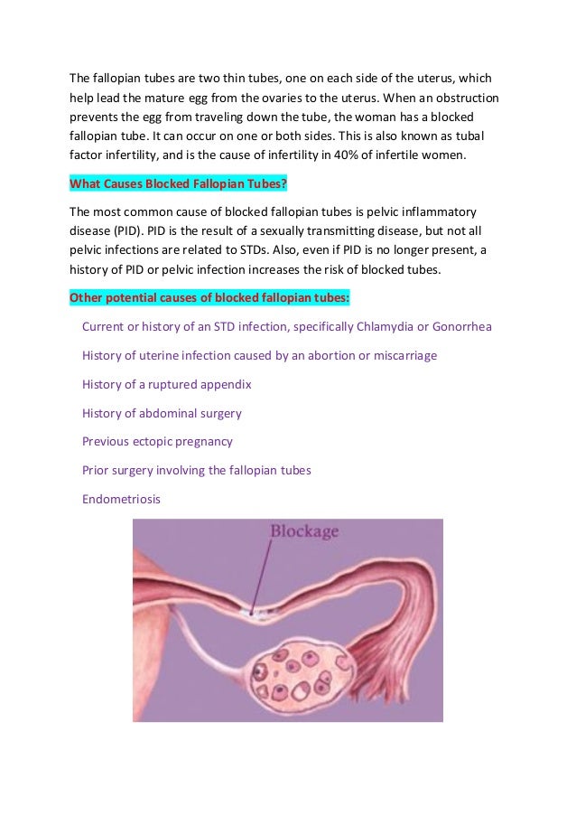Fallopian Tube Procedures for Infertility