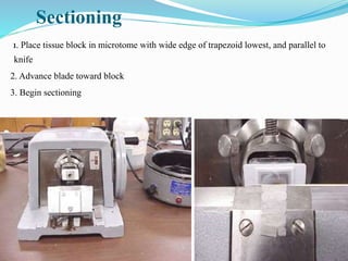 BLOCK PREPARATION.pptx