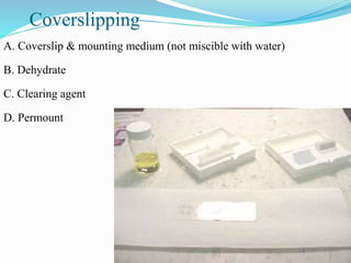 BLOCK PREPARATION.pptx