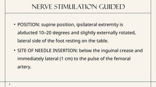 Comprehensive Guide to Nerve Blocks for Femur Surgeries Using ...