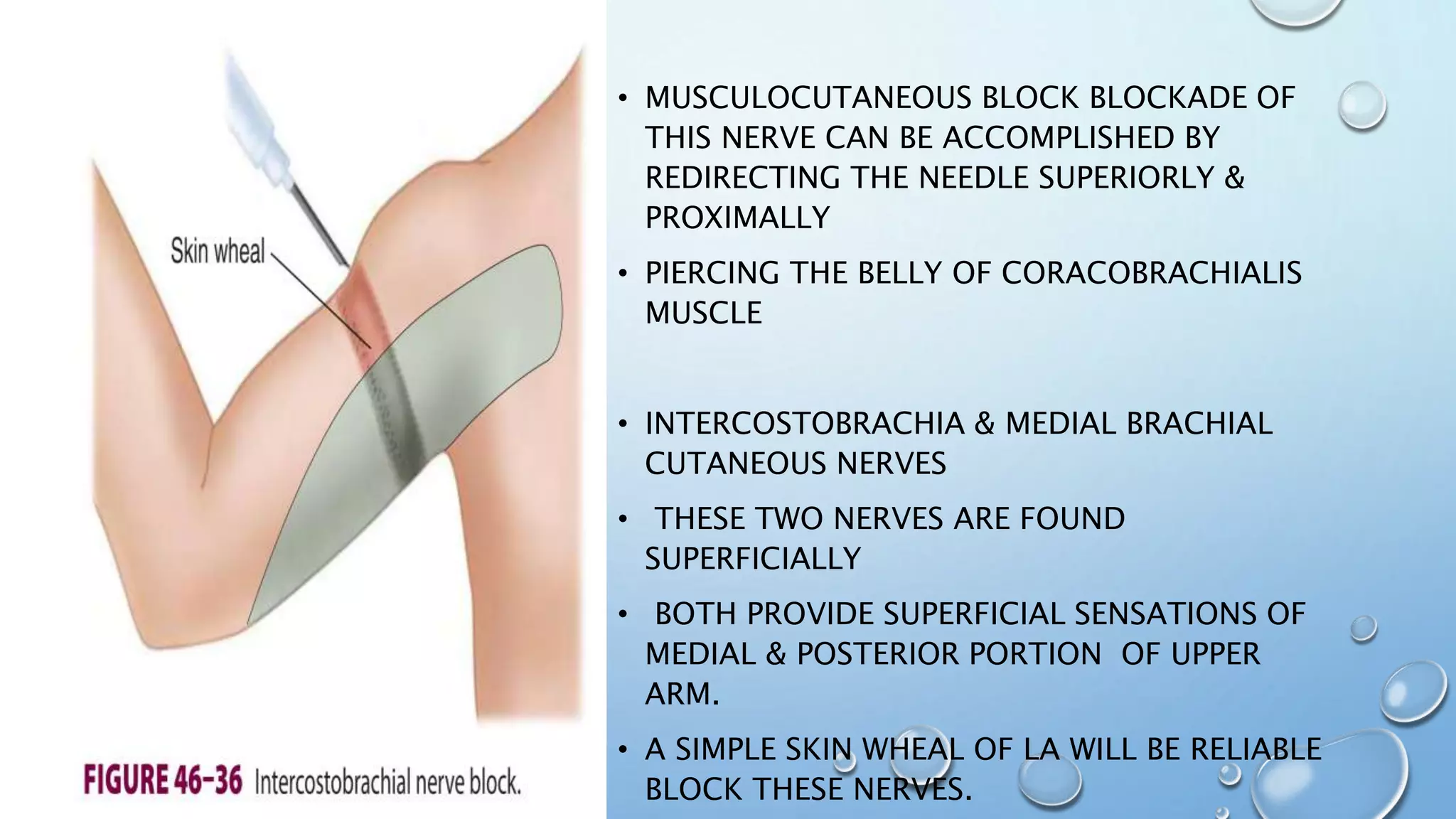 • MUSCULOCUTANEOUS BLOCK BLOCKADE OF
THIS NERVE CAN BE ACCOMPLISHED BY
REDIRECTING THE NEEDLE SUPERIORLY &
PROXIMALLY
• PIERCING THE BELLY OF CORACOBRACHIALIS
MUSCLE
• INTERCOSTOBRACHIA & MEDIAL BRACHIAL
CUTANEOUS NERVES
• THESE TWO NERVES ARE FOUND
SUPERFICIALLY
• BOTH PROVIDE SUPERFICIAL SENSATIONS OF
MEDIAL & POSTERIOR PORTION OF UPPER
ARM.
• A SIMPLE SKIN WHEAL OF LA WILL BE RELIABLE
BLOCK THESE NERVES.
 