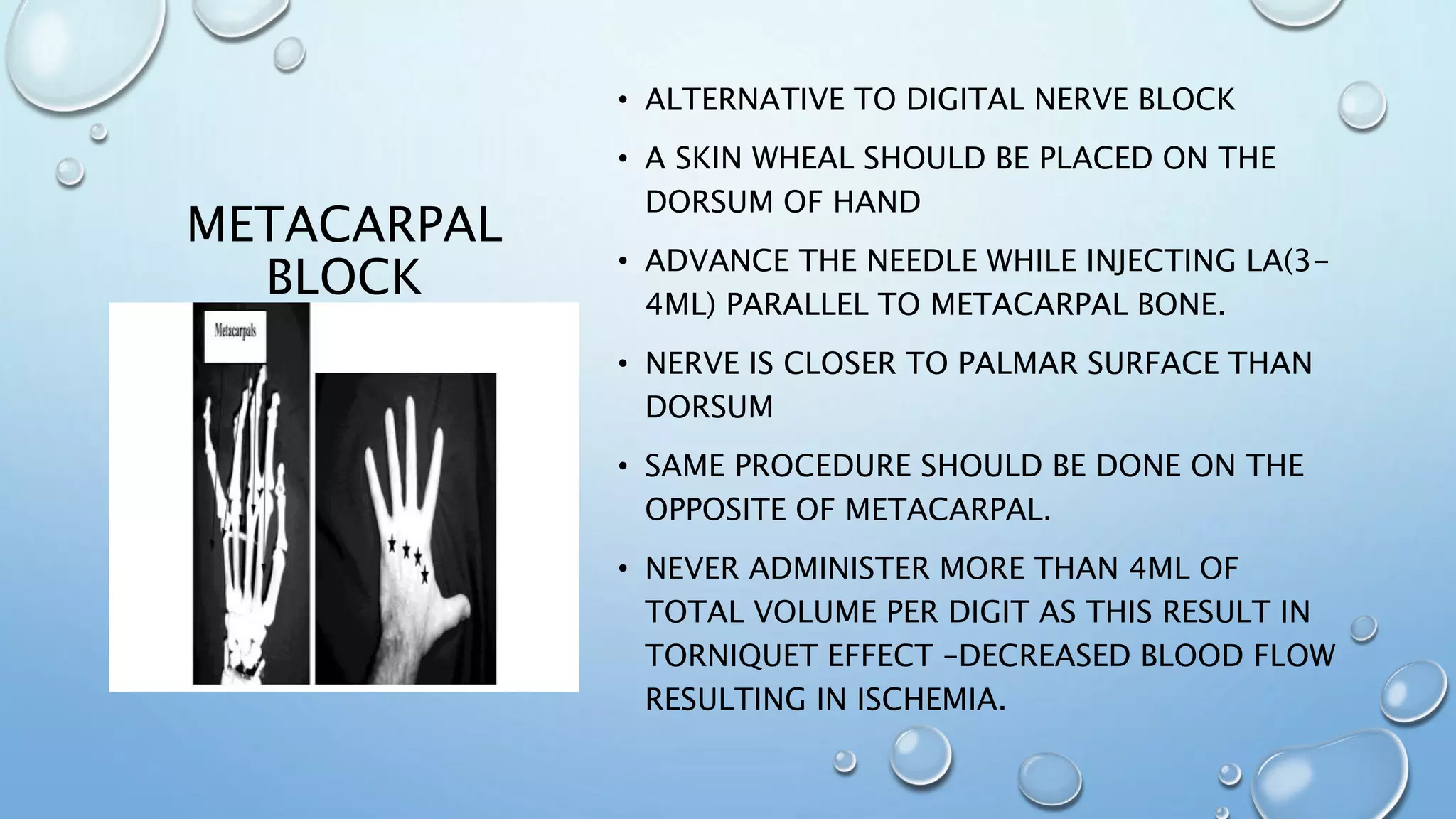 METACARPAL
BLOCK
• ALTERNATIVE TO DIGITAL NERVE BLOCK
• A SKIN WHEAL SHOULD BE PLACED ON THE
DORSUM OF HAND
• ADVANCE THE NEEDLE WHILE INJECTING LA(3-
4ML) PARALLEL TO METACARPAL BONE.
• NERVE IS CLOSER TO PALMAR SURFACE THAN
DORSUM
• SAME PROCEDURE SHOULD BE DONE ON THE
OPPOSITE OF METACARPAL.
• NEVER ADMINISTER MORE THAN 4ML OF
TOTAL VOLUME PER DIGIT AS THIS RESULT IN
TORNIQUET EFFECT –DECREASED BLOOD FLOW
RESULTING IN ISCHEMIA.
 