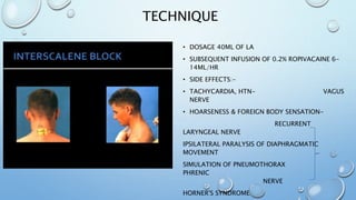 TECHNIQUE
• DOSAGE 40ML OF LA
• SUBSEQUENT INFUSION OF 0.2% ROPIVACAINE 6-
14ML/HR
• SIDE EFFECTS:-
• TACHYCARDIA, HTN- VAGUS
NERVE
• HOARSENESS & FOREIGN BODY SENSATION-
RECURRENT
LARYNGEAL NERVE
IPSILATERAL PARALYSIS OF DIAPHRAGMATIC
MOVEMENT
SIMULATION OF PNEUMOTHORAX
PHRENIC
NERVE
HORNER'S SYNDROME
 