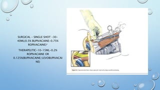 SURGICAL – SINGLE SHOT -30-
40ML(0.5% BUPIVACAINE-0.75%
ROPIVACAINE)*
THERAPEUTIC-10-15ML-0.2%
ROPIVACAINE OR
0.125%(BUPIVACAINE/LEVOBUPIVACAI
NE)
 