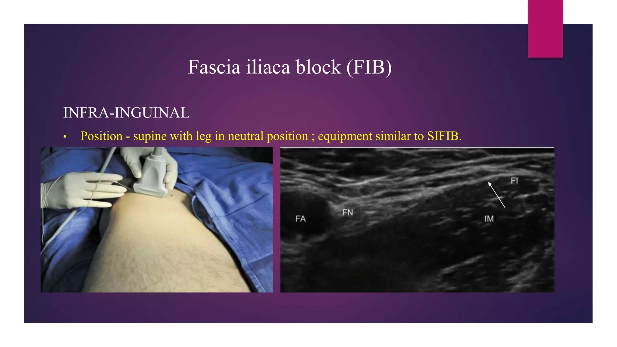 Blocks Lower limb.pptx