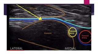 Blocks Lower limb.pptx