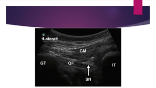 Blocks Lower limb.pptx
