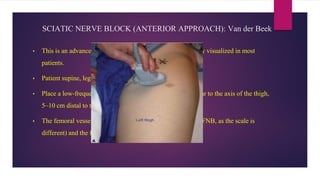 SCIATIC NERVE BLOCK (ANTERIOR APPROACH): Van der Beek
• This is an advanced block, as the nerve is deep and not easily visualized in most
patients.
• Patient supine, legs slightly abducted.
• Place a low-frequency (3–5 Mhz) curved probe perpendicular to the axis of the thigh,
5–10 cm distal to the inguinal crease.
• The femoral vessels (much smaller than when performing a FNB, as the scale is
different) and the femur can easily be visualized.
 