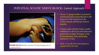 POPLITEAL SCIATIC NERVE BLOCK- Lateral Approach
• 10-cm, 21-gauge needle is inserted in
a horizontal plane perpendicular to the
long axis of the leg between the
Vastus lateralis and Biceps femoris
muscles
• Contact made with the femur, needle
withdrawn to skin level and redirected
posteriorly at angle 30 degree to the
horizontal plane with stimulating
current of 1.5 mA
• Goal: to see the foot movements at
current of 0.2-0.5 mA
 