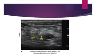 Blocks Lower limb.pptx