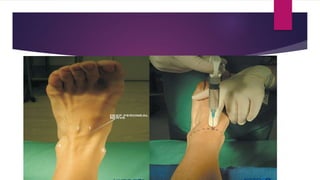 Blocks Lower limb.pptx