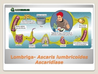 Lombriga- Ascaris lumbricoides
Ascaridíase
 