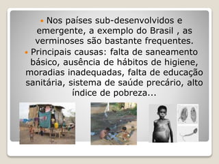  Nos países sub-desenvolvidos e
emergente, a exemplo do Brasil , as
verminoses são bastante frequentes.
 Principais causas: falta de saneamento
básico, ausência de hábitos de higiene,
moradias inadequadas, falta de educação
sanitária, sistema de saúde precário, alto
índice de pobreza...
 