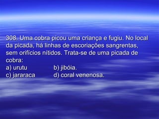 308. Uma cobra picou uma criança e fugiu. No local308. Uma cobra picou uma criança e fugiu. No local
da picada, há linhas de escoriações sangrentas,da picada, há linhas de escoriações sangrentas,
sem orifícios nítidos. Trata-se de uma picada desem orifícios nítidos. Trata-se de uma picada de
cobra:cobra:
a) urutua) urutu b) jibóia.b) jibóia.
c) jararacac) jararaca d) coral venenosa.d) coral venenosa.
 