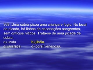 308. Uma cobra picou uma criança e fugiu. No local308. Uma cobra picou uma criança e fugiu. No local
da picada, há linhas de escoriações sangrentas,da picada, há linhas de escoriações sangrentas,
sem orifícios nítidos. Trata-se de uma picada desem orifícios nítidos. Trata-se de uma picada de
cobra:cobra:
a) urutua) urutu b) jibóia.b) jibóia.
c) jararacac) jararaca d) coral venenosa.d) coral venenosa.
 