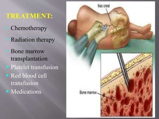 TREATMENT:
• Chemotherapy
• Radiation therapy
• Bone marrow
transplantation
 Platelet transfusion
 Red blood cell
transfusion
 Medications
 