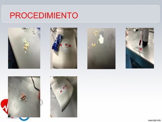 PROCEDIMIENTO
 