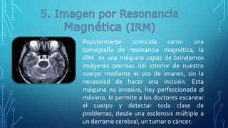 Popularmente conocida como una
tomografía de resonancia magnética, la
IRM es una máquina capaz de brindarnos
imágenes precisas del interior de nuestro
cuerpo mediante el uso de imanes, sin la
necesidad de hacer una incisión. Esta
máquina no invasiva, hoy perfeccionada al
máximo, le permite a los doctores escanear
el cuerpo y detectar toda clase de
problemas, desde una esclerosis múltiple a
un derrame cerebral, un tumor o cáncer.
 