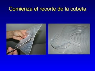 Comienza el recorte de la cubeta 