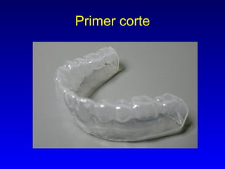 Primer corte 