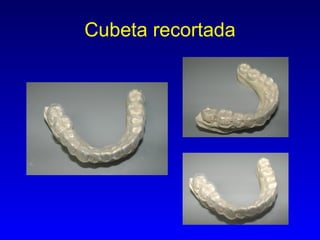 Cubeta recortada 