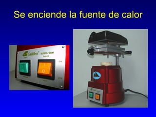 Se enciende la fuente de calor 
