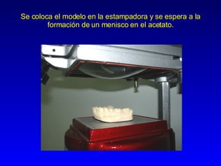 Se coloca el modelo en la estampadora y se espera a la formación de un menisco en el acetato. 