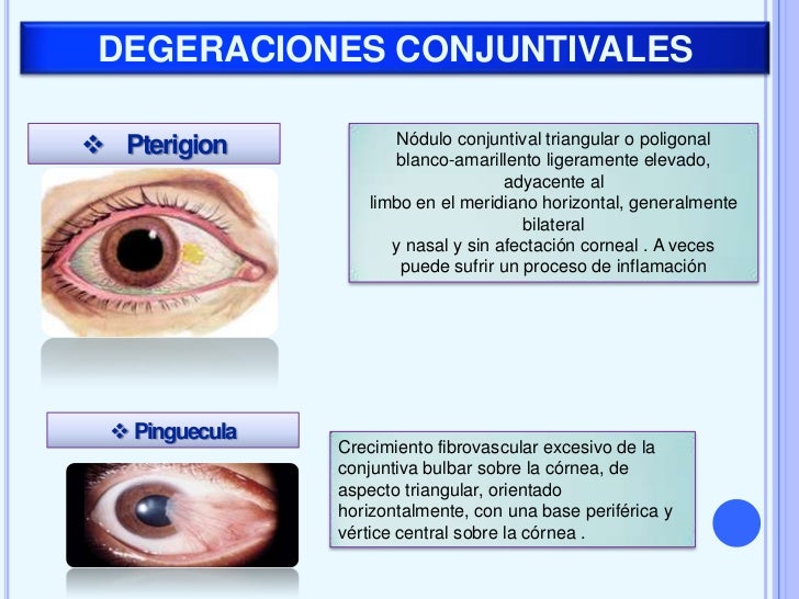 Arrimon angulo de cerca a oficinista 9