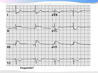 Frequentie?
 
