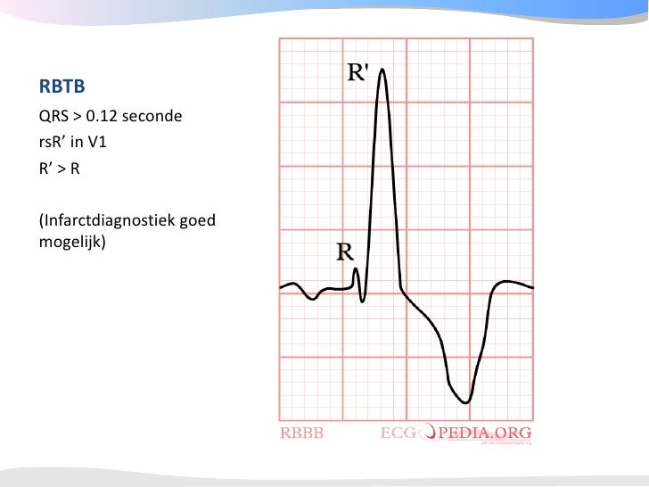 Introductie ECG