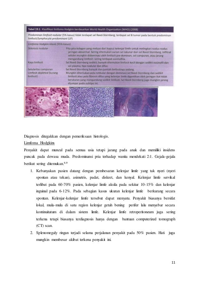 Blok 24 (limfoma hodgkin)