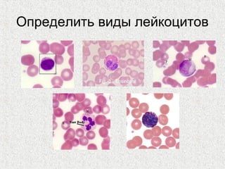 Определить виды лейкоцитов
 